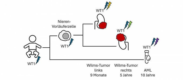 Pada anak dengan kecenderungan genetik terhadap tumor Wilms, seluruh sel tubuh a