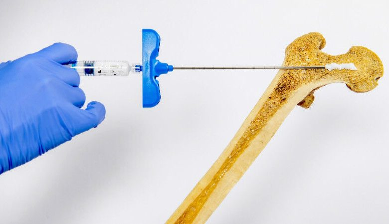 Demonstrasi hidrogel yang mudah disuntikkan © Flowbone/EPFL LBO