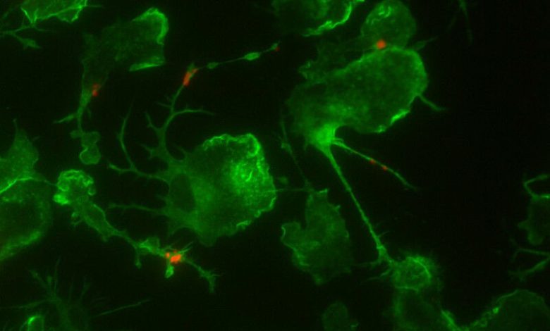 Gambar mikroskop ini - menunjukkan mikroglia (hijau) fagositosis amiloid -beta (merah)