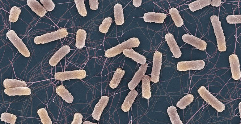 Gambar mikroskop pemindaian-elektron yang menunjukkan bakteri Salmonella. (Gambar: Universi