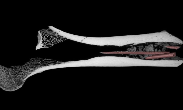 Bone berusia 7.000 tahun memegang 3 panah dengan racun campuran-yang tertua dari jenisnya dalam catatan