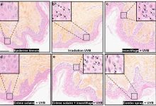 Gambar 1 - Analisis histometrik biopsi kulit manusia yang diiradiasi UVB setelah Appl