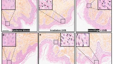 Gambar 1 - Analisis histometrik biopsi kulit manusia yang diiradiasi UVB setelah Appl