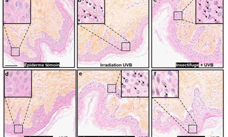 Gambar 1 - Analisis histometrik biopsi kulit manusia yang diiradiasi UVB setelah Appl