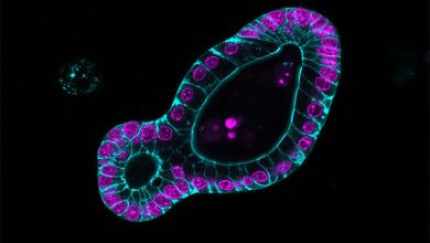 Peneliti FMI telah menemukan bagaimana organoid usus membentuk crypts, rumah mana