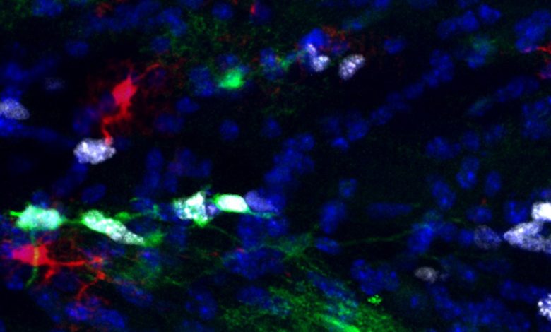Gambar mikroskop fluoresen yang beresolusi tinggi dari astrosit di otak. Astrosit ditampilkan dalam warna merah dan hijau dan yang proliferatif juga putih. Mereka terlihat seperti gumpalan dengan latar belakang hitam.