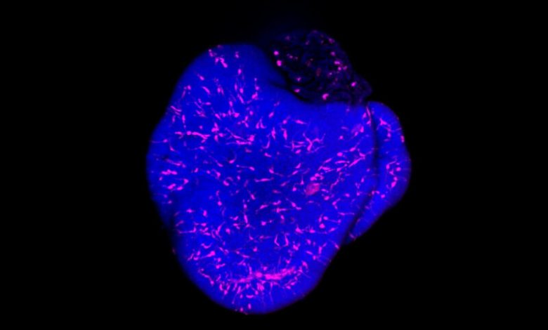 Langit merah muda. Mikroglia (magenta) diintegrasikan ke dalam organoid retina. Sel nuc