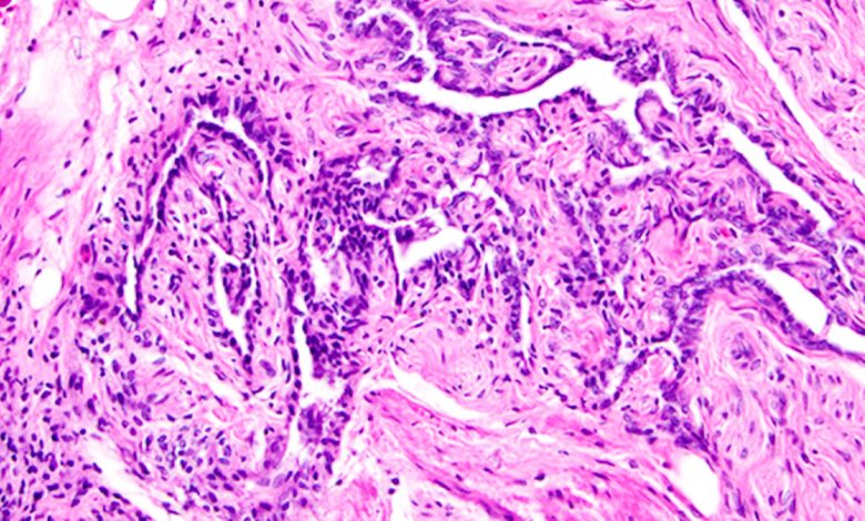 Organ wanita 'tidak berguna' yang ditemukan lebih dari seabad yang lalu sebenarnya dapat mendukung ovarium, studi menemukan