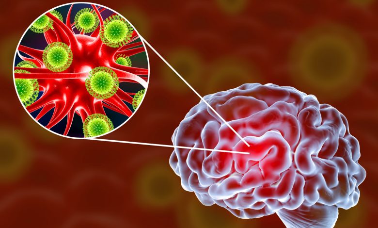 Ilustrasi otak (di sebelah kanan) dengan gelembung pop-out keluar (di sebelah kiri) menunjukkan partikel virus menyerang neuron.