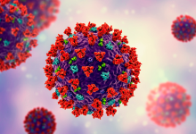 Dilema Diagnostik: Seorang pria mengalami cegukan selama 5 hari - dan virus mungkin telah disalahkan
