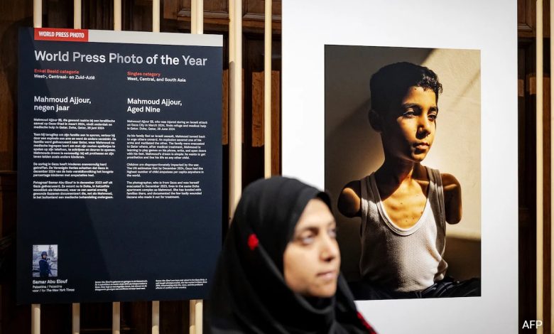 Potret Bocah Palestina yang kehilangan kedua lengan dalam serangan Israel memenangkan World Press Photo Award