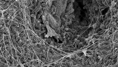 Bakteri Vibrio Cholerae, foto diambil dengan mikroskop elektron pemindaian. 2025