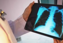 Viz.ai mitra dengan regeneron, sanofi untuk mempelajari alat COPD