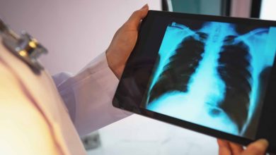 Viz.ai mitra dengan regeneron, sanofi untuk mempelajari alat COPD