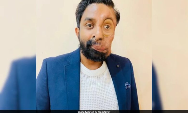 Pria Origin India mengklaim London Cafe menolaknya layanan karena wajahnya: "Semua orang menatapku"