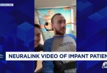 Neuralink berbagi video pasien bermain catur menggunakan sinyal dari implan otak