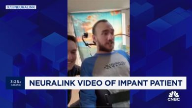 Neuralink berbagi video pasien bermain catur menggunakan sinyal dari implan otak