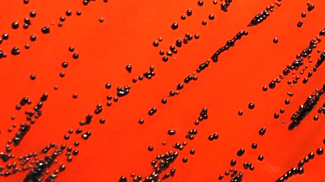 Koloni hitam khas bakteri difteri (Corynebacterium diphtheriae), cul