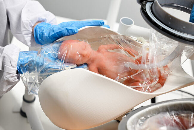 Sistem pendukung kehidupan perinatal Aquawomb berfokus pada transisi yang aman dari
