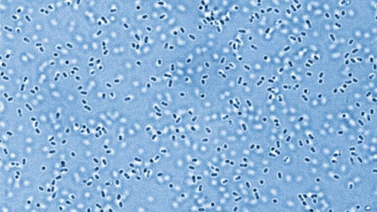 Gambar mikroskop elektron berwarna biru dari Pandoraea sputorum, patogen dari th