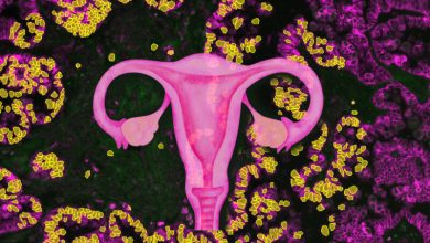 Sistem reproduksi wanita sebagai fokus penelitian ini di latar belakang SER