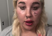 Amanda Bynes mengumumkan mendapatkan ozempic
