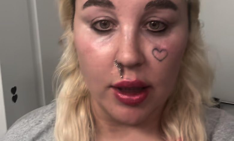 Amanda Bynes mengumumkan mendapatkan ozempic